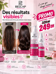 Pack Duo Anti-chute BELCAP – Shampoing & Lotion